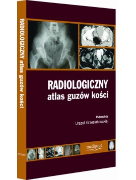Radioologiczny atlas guzów kości
